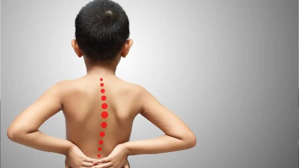 Kids are facing back issues due to lifestyle habits says AIIMS survey