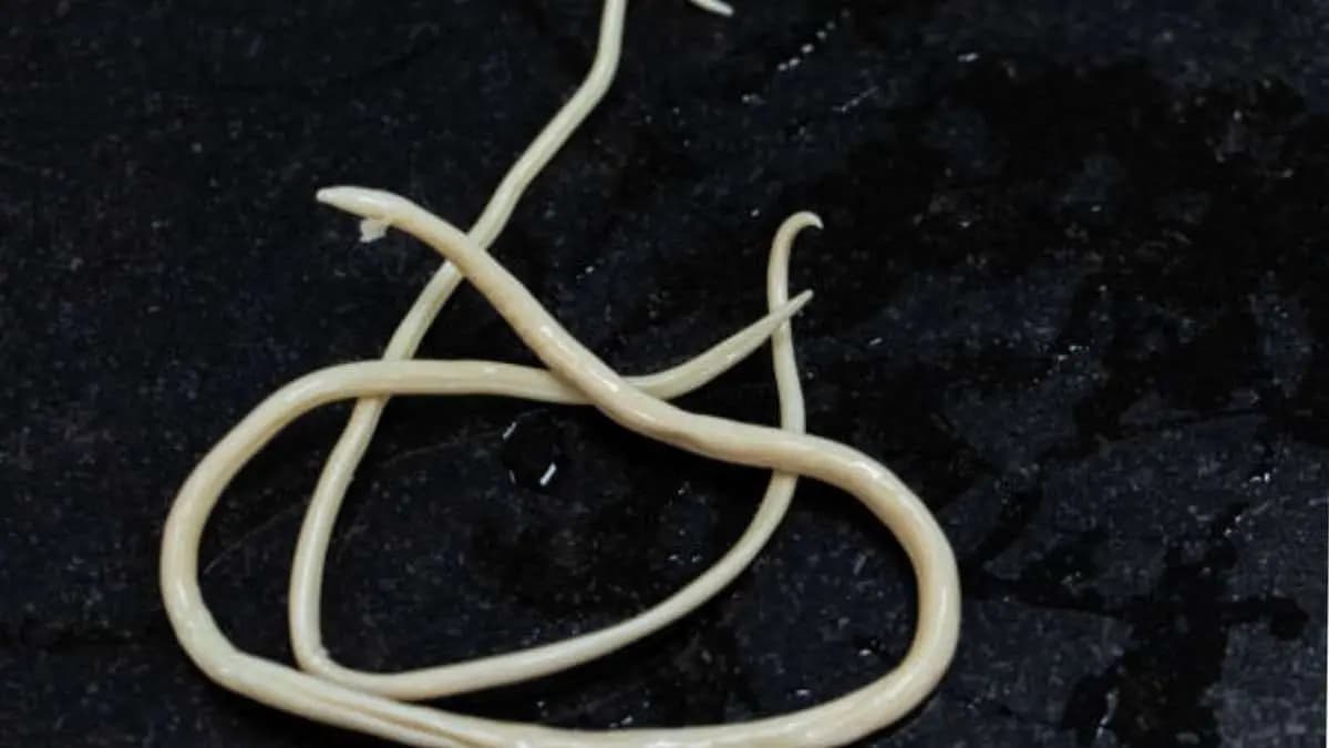 worms have bad effects on health from child to adults body lif