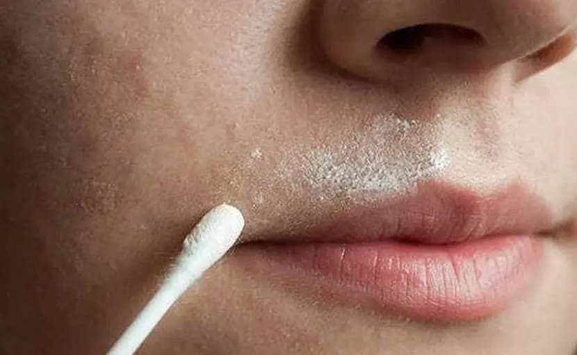 This home remedy helps to remove facial hair easily lif