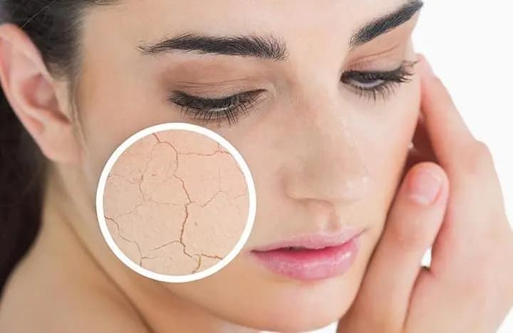 These all foods increased collagen level in your body and gives a bright skin and hair lif