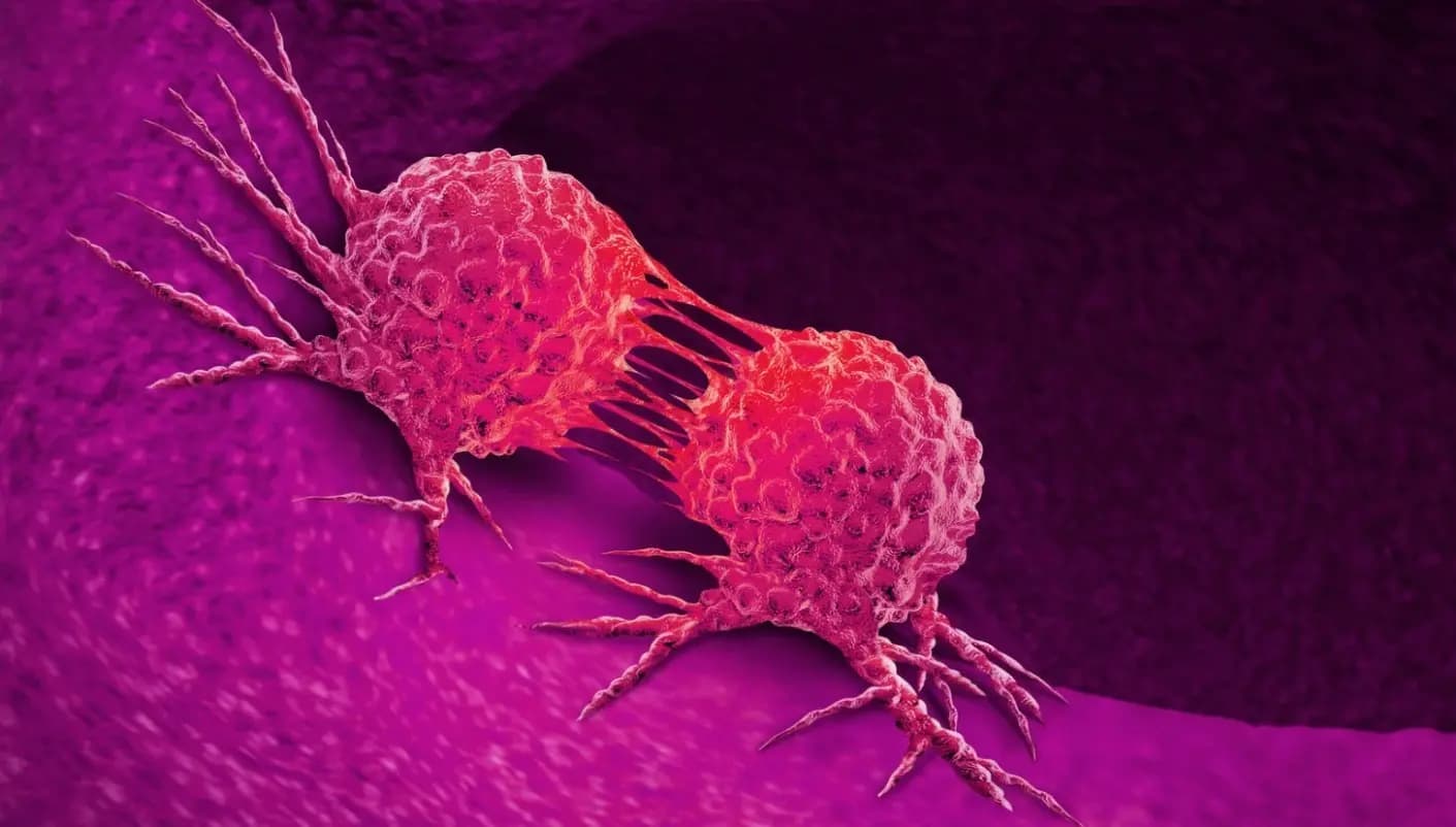 First AI-based cancer treatment in the country