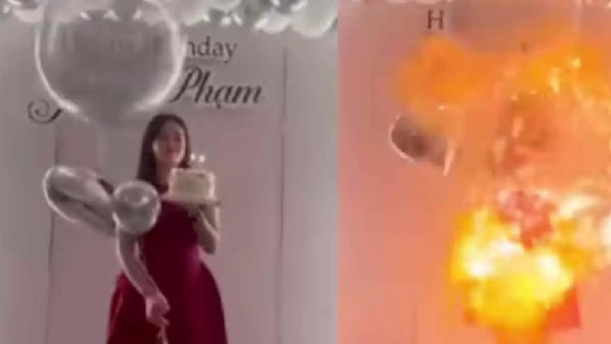  Vietnamese woman's face burned on her birthday