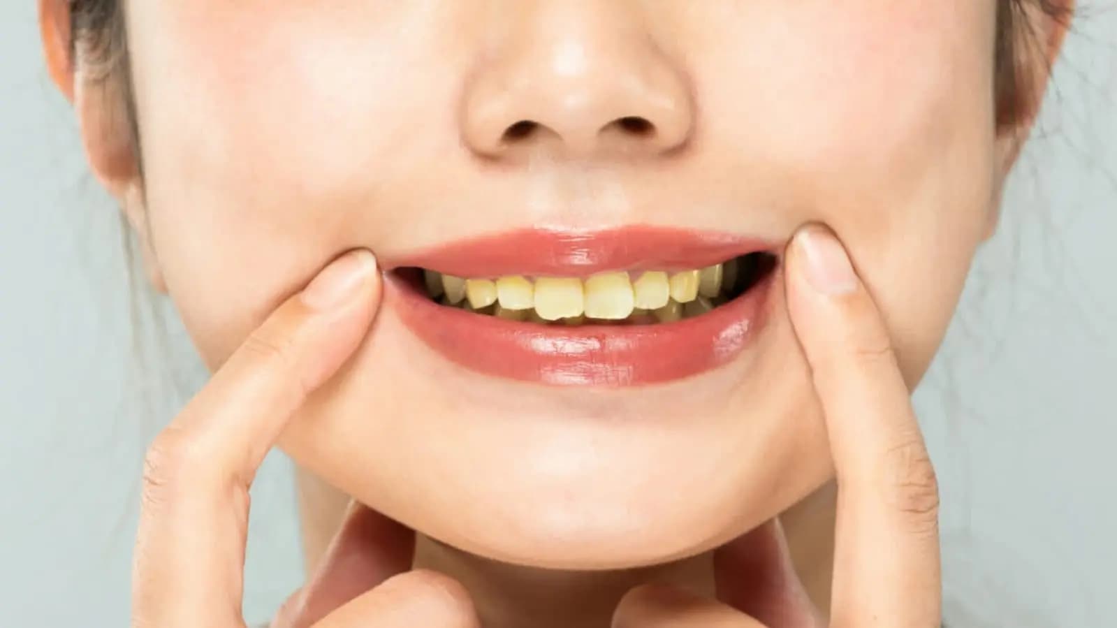 how  to whitening yellow teeth lif