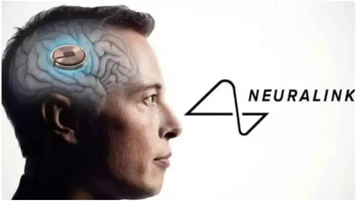chip transplant successful in human brain