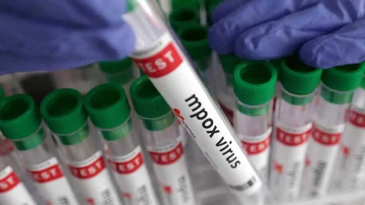 To Handle Mpox Cases Identify Facilities Trained People gnr