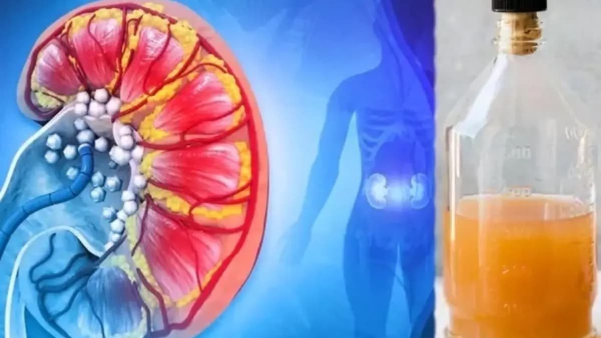 Drinking this juice twice a week will completely cleanse your kidneys lif