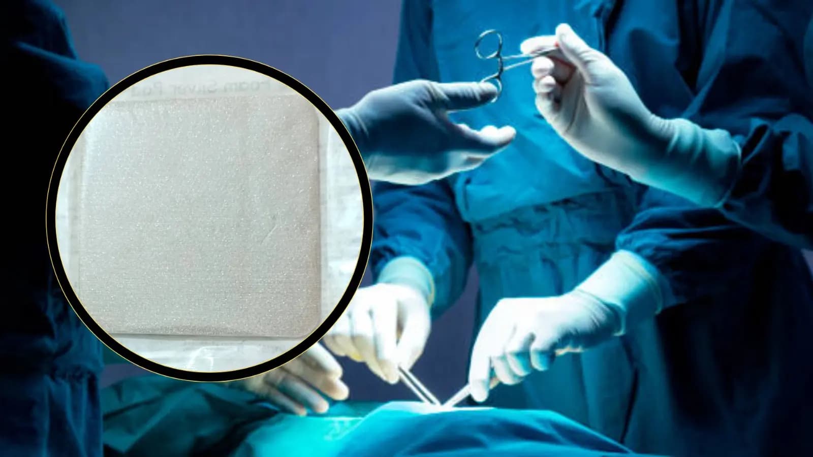 Medical Experiment The Doctors are experimenting Silver Dressing Pad to heal the wounds_gnr