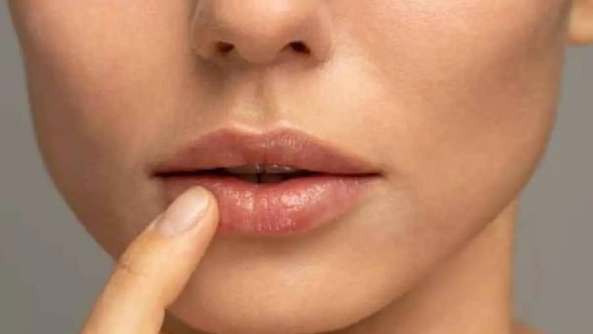These home remedies help to get smooth lips 