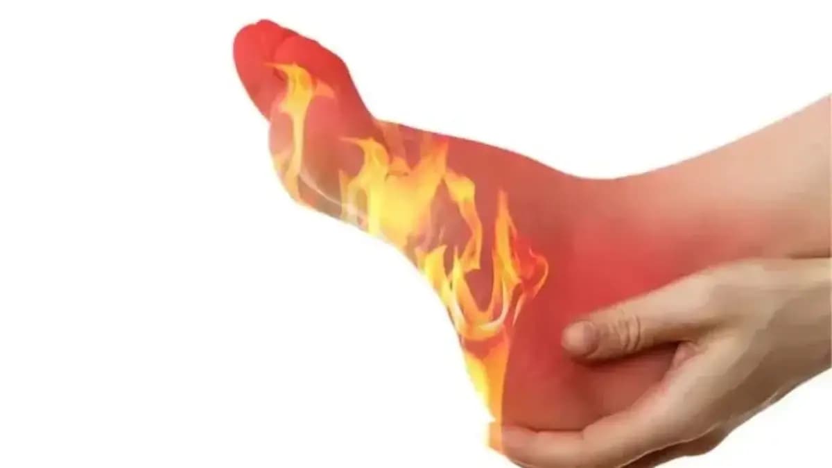 Burning sensation in feet is a big sign of these serious diseases