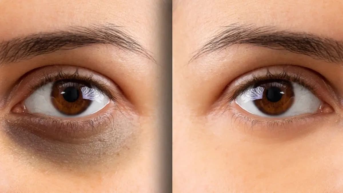 This vegetable juice can reduce dark circle problem in just 7 days 