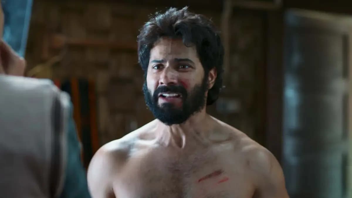 Bollywood actor Varun Dhawan injured during shooting