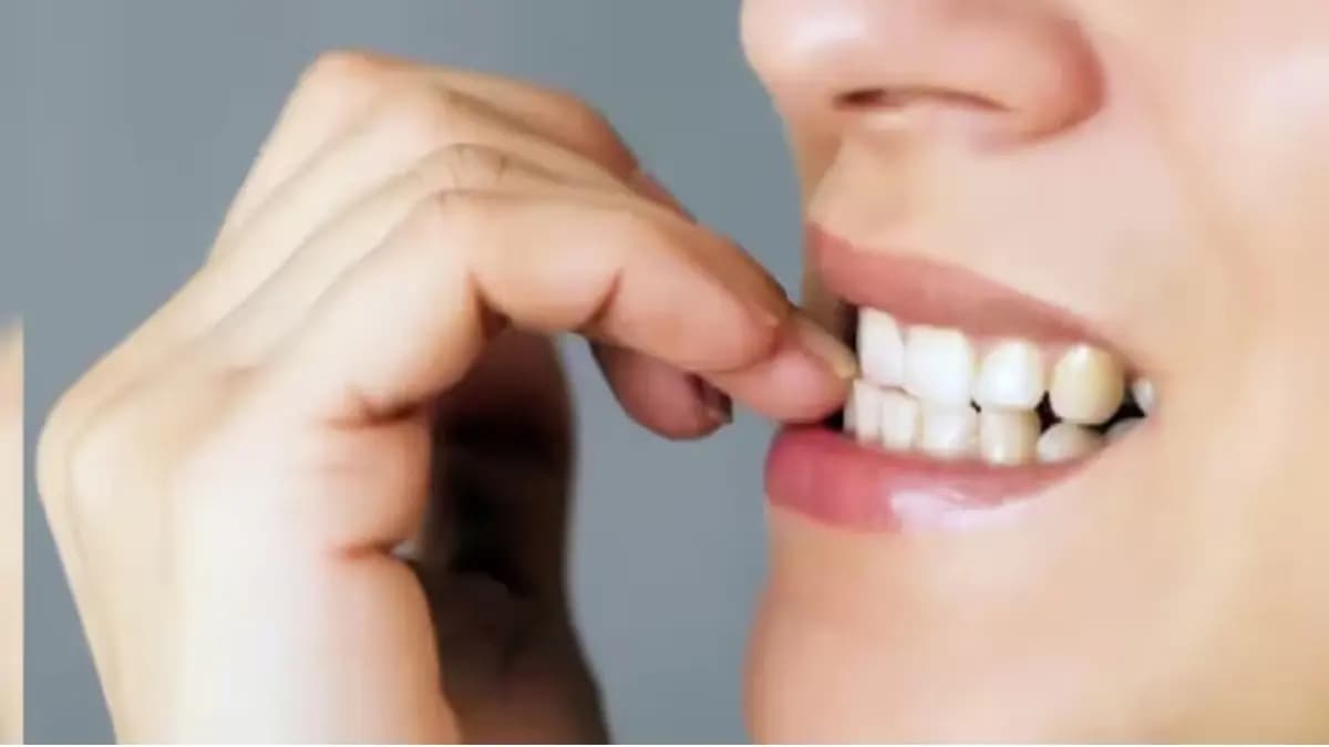  What are the side effects of biting nails things you should know details inside lif