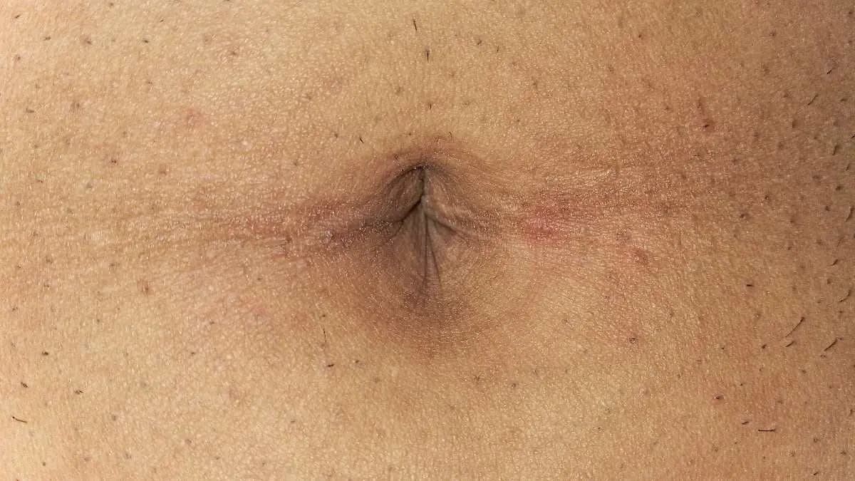 Belly button harbours millions of rare bacteria