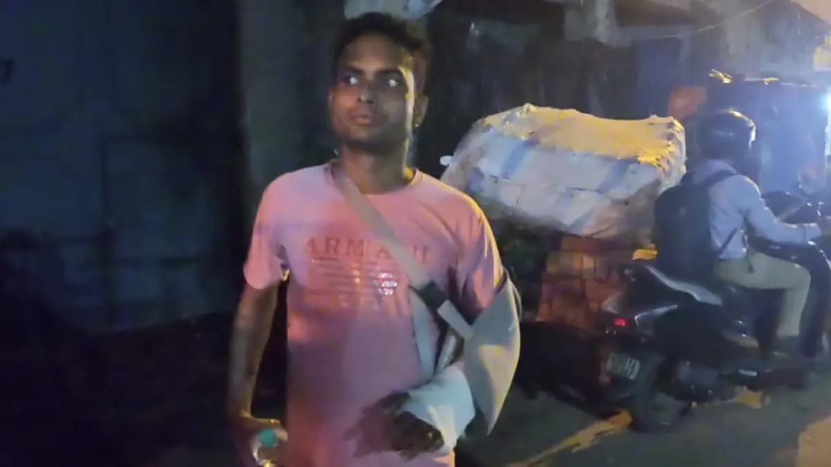 Doctors of SSKM successfully restored chopped hands of a youth gnr