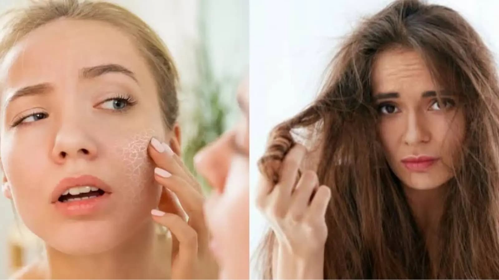 Easy home remedies for skin and hair care