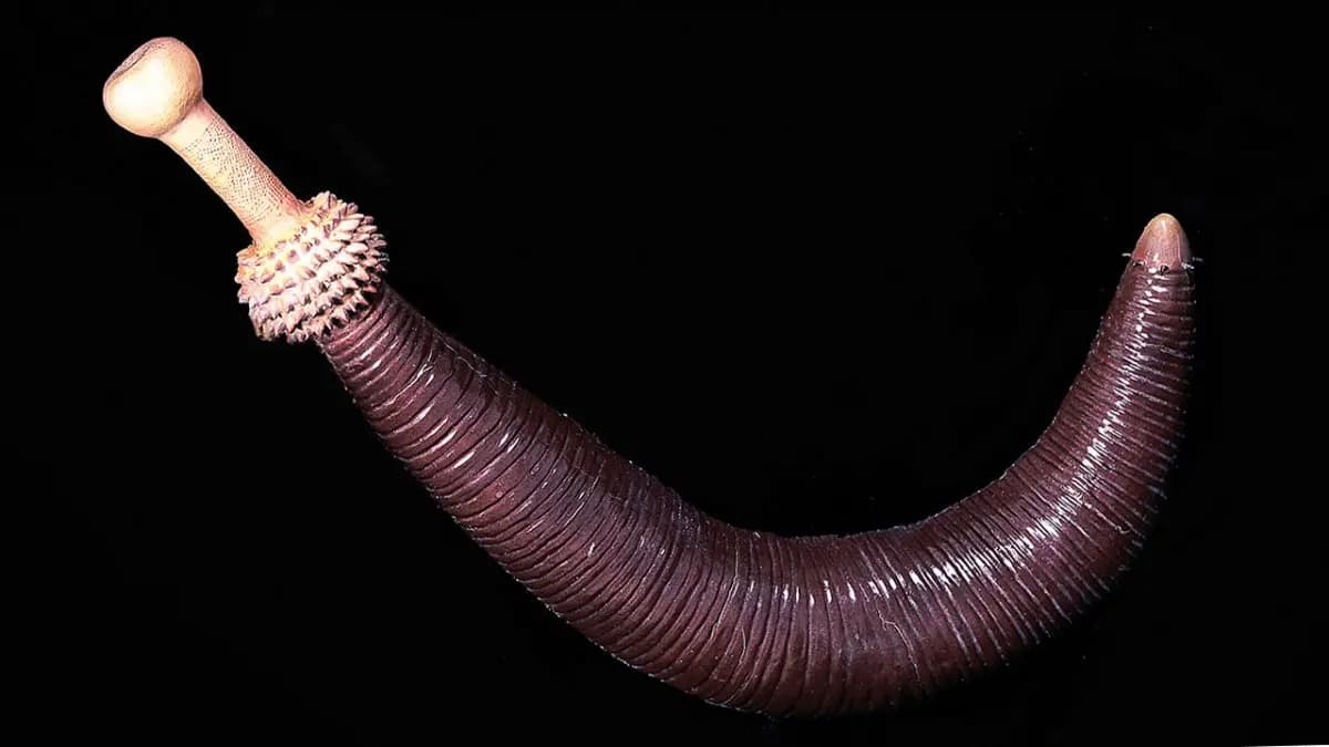 Man hospitalised after rare parasite infestation