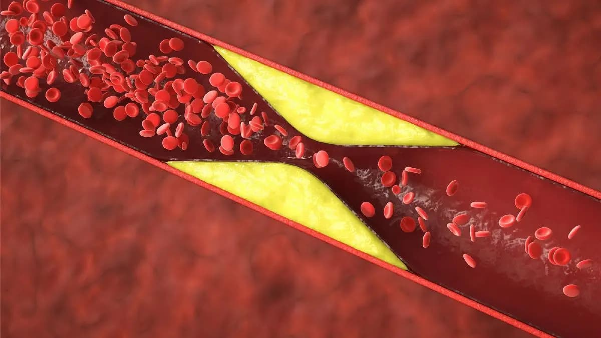 Body give these symptoms when Coronary artery is blocked