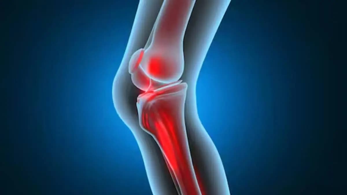How to use bay leaves and garlic for joint pain