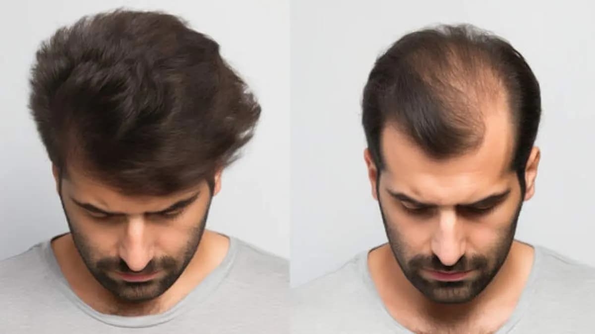  this home made natural hair mask can easily stop hair fall problem and helps to grow new hair make your hair thick long and black also lif 