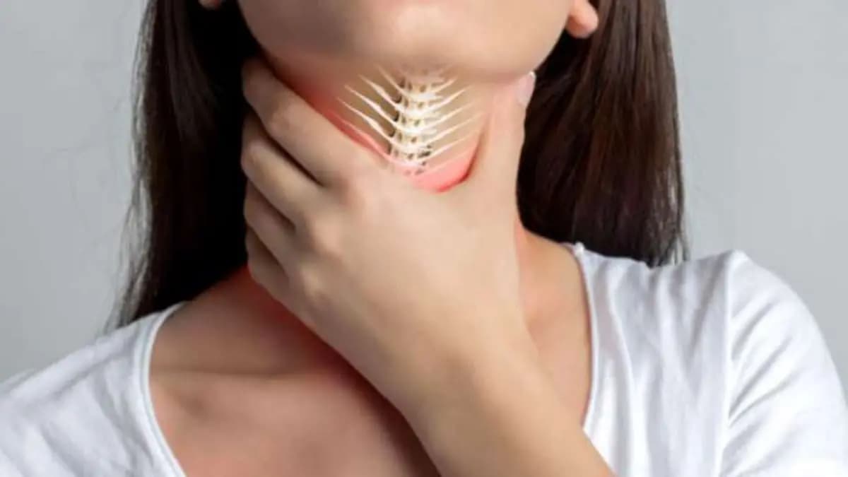 fish bone stuck in throat remedies lif