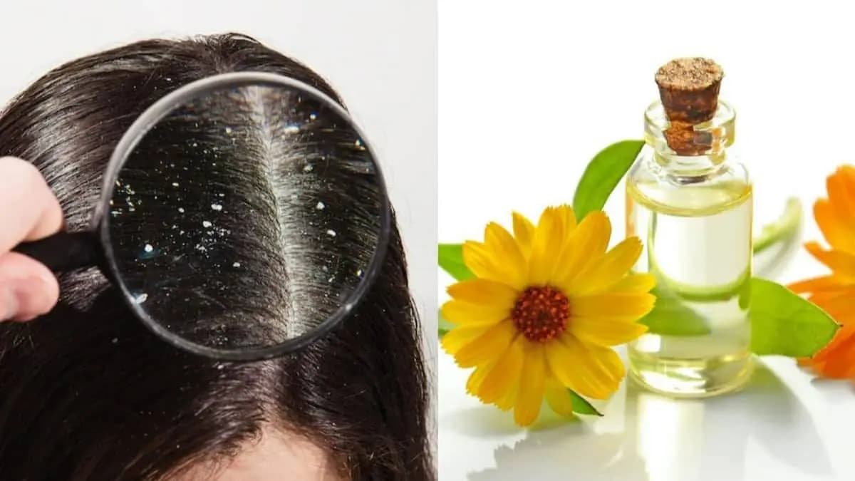 this home made natural hair oil can prevent dandruff problem increase hair growth and make your hair thick and shiny lif 
