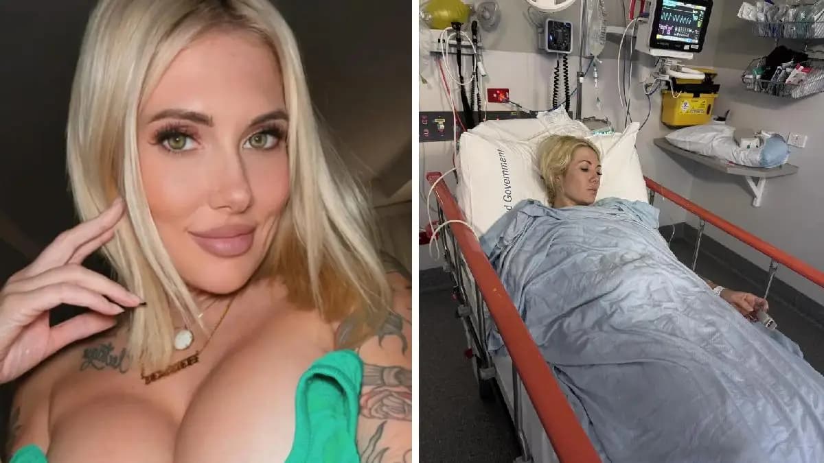Australian model was struck by lightning and it changed the colour of her pupils