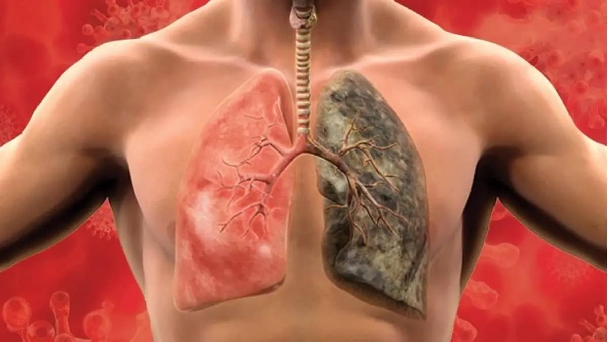 These foods help in reversing damage caused by smoking