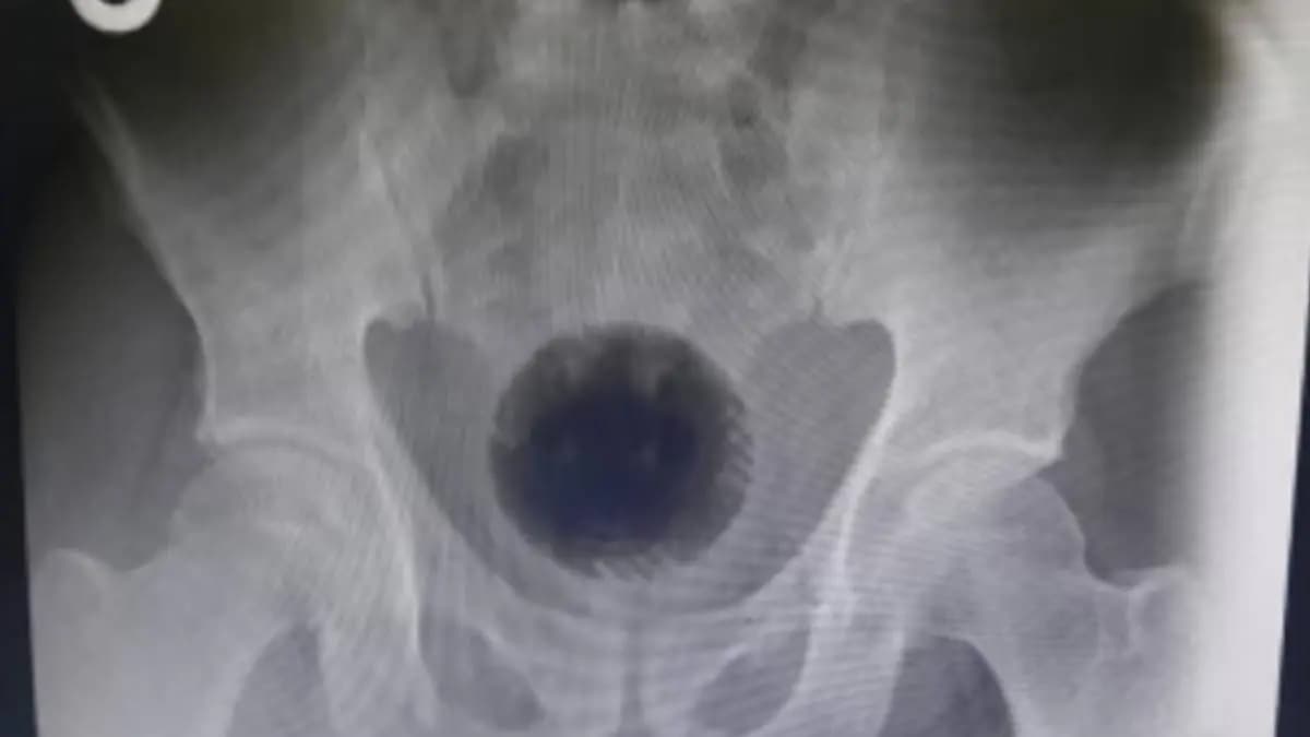 uluberia mill worker dies out of prank gnr