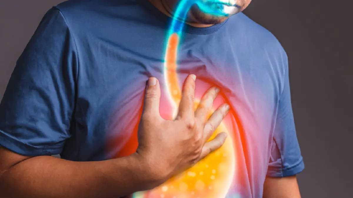 Three Home remedy for acid reflux