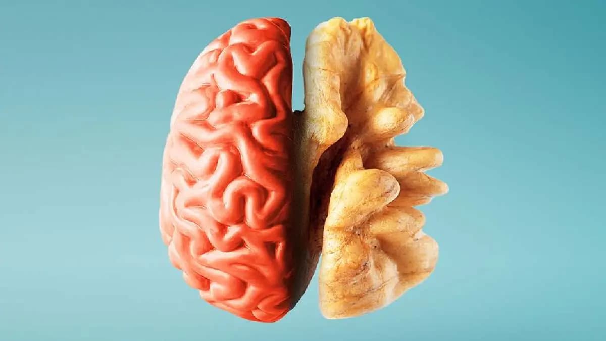 Health Benefits of Walnuts