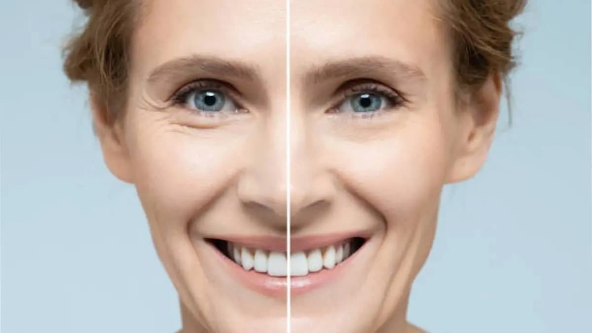  this home made natural anti aging face cream made by carrot which is rich with vitamin c is very effective for your skin and make it bright and shiny lif