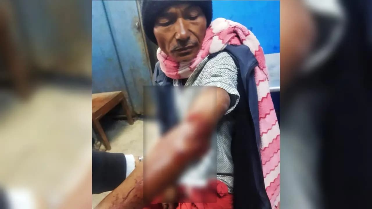 A person injured in a cheetah attack in Falakatta