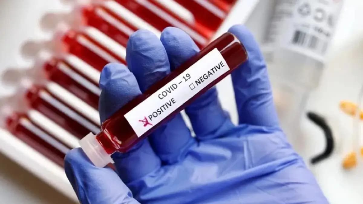 Covid 19 Update expert says if you have these symptoms must get tested for COVID 19