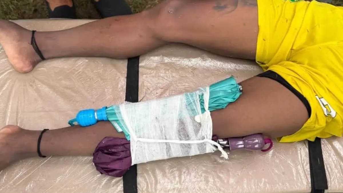 Railway FC player Tarak Hembram injured against Mohun Bagan and the sorry state of CFL comes out 