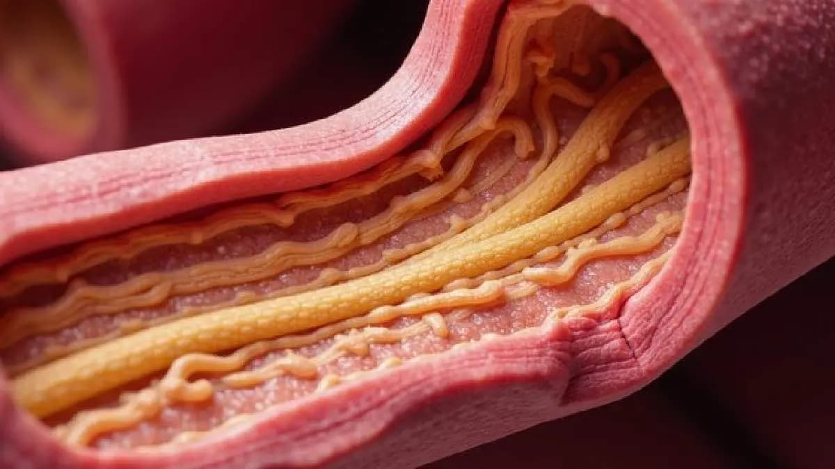 Superfoods which could help reduce cholesterol and clogged arteries
