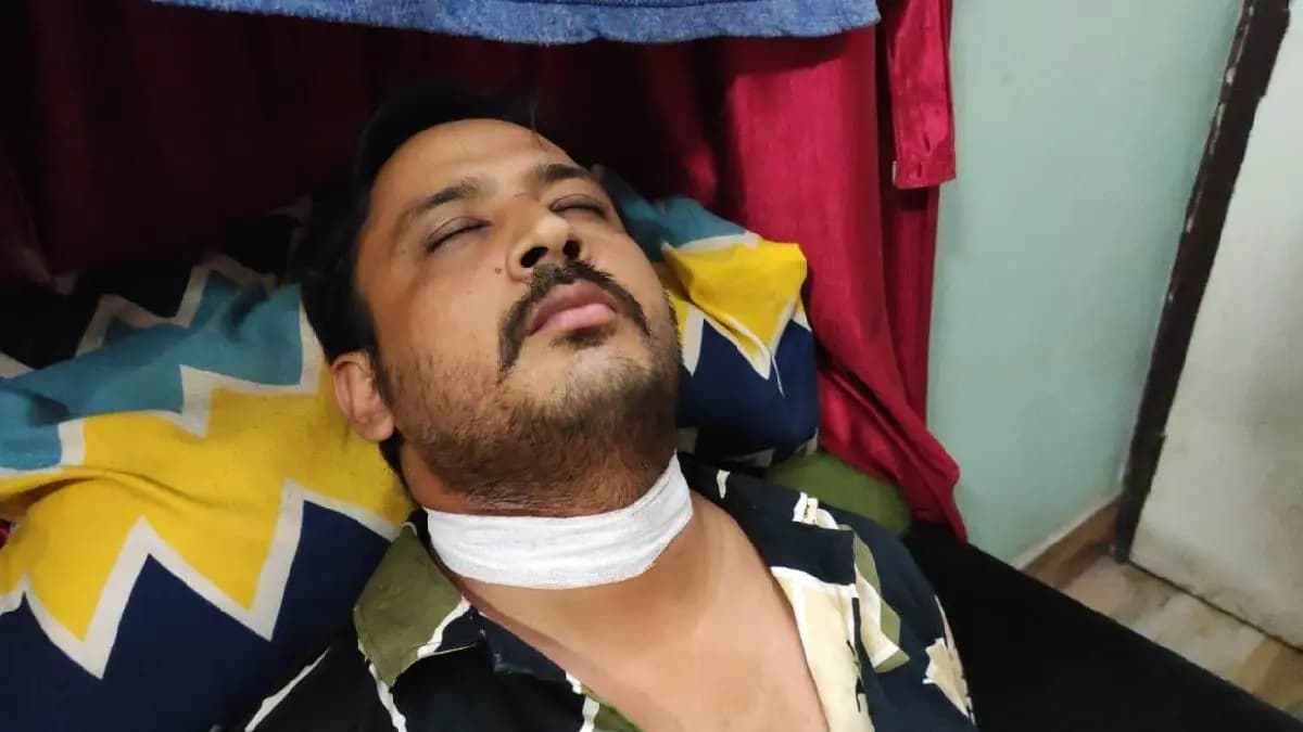  A Man And His Son Got Heavily Injured with a Chinese Thread 
