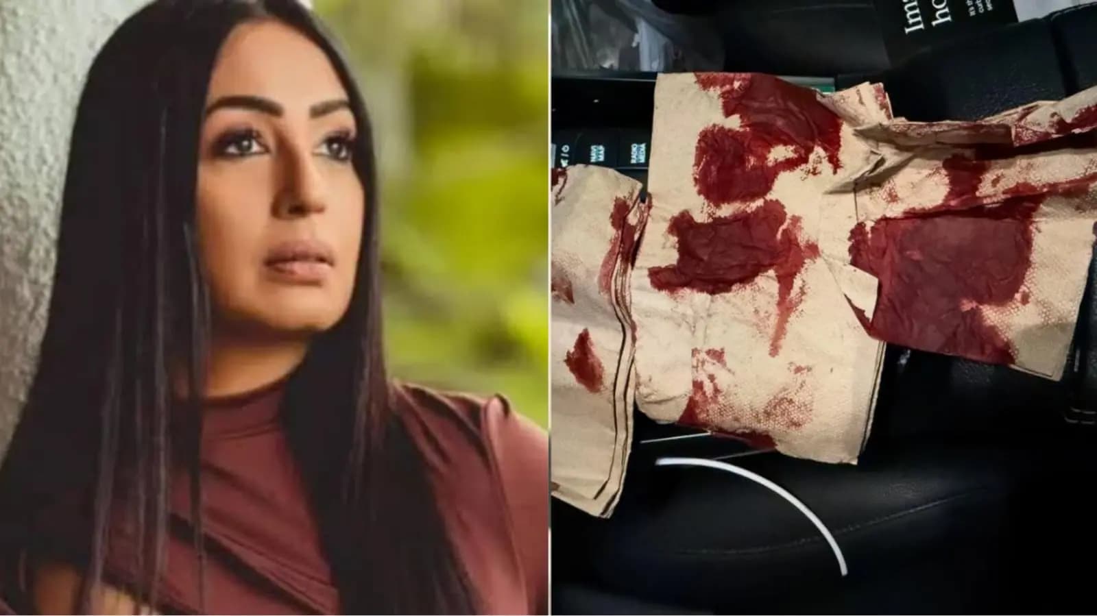actress kashmera shah met with freak accident in foreign country ent