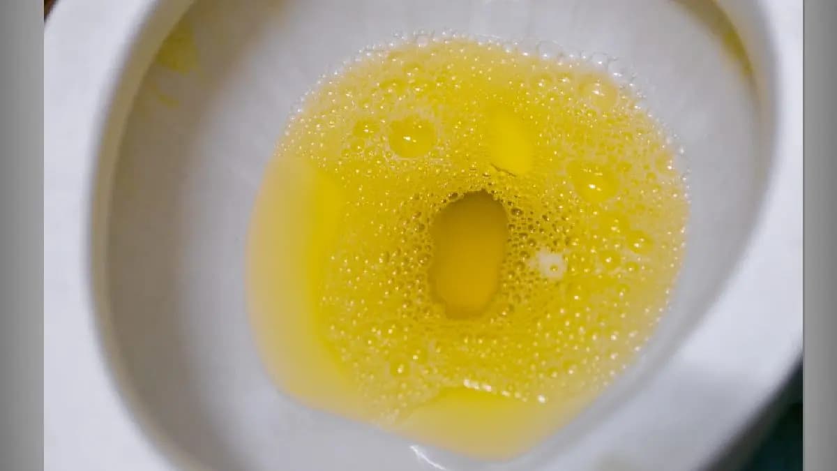 Dehydration among top reasons of Yellow Urine