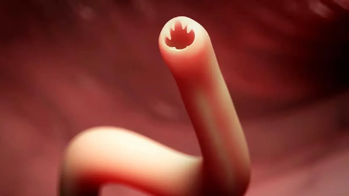How dangerous is the bizarre fox Tapeworm contamination for human
