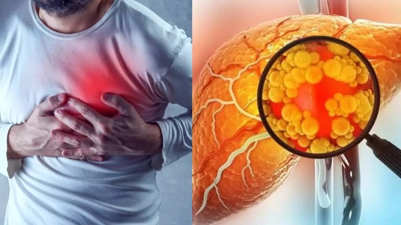 Excess Cooking Oil Causes Fatty Liver And Heart Risks know other health issues for this food habit