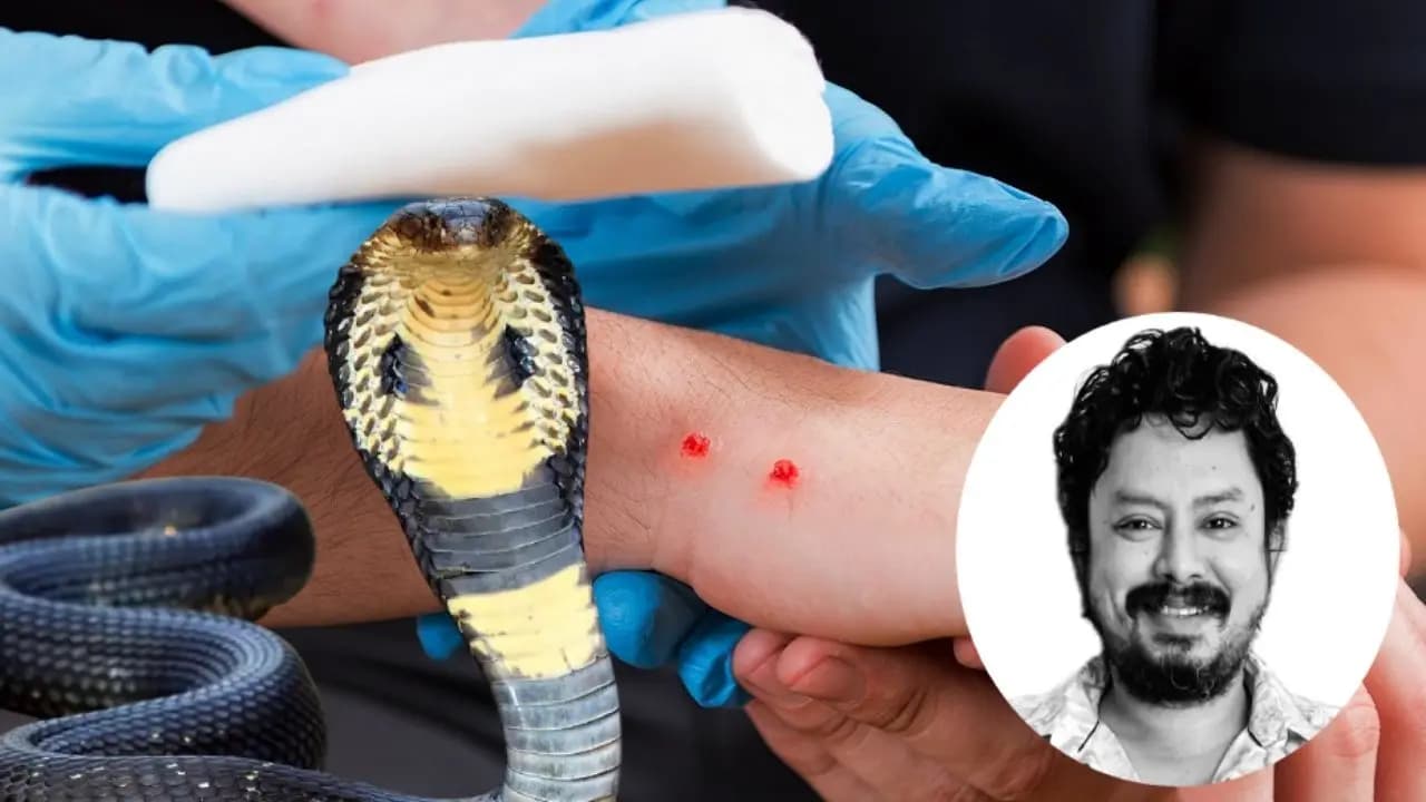 Snakebite Symptoms
