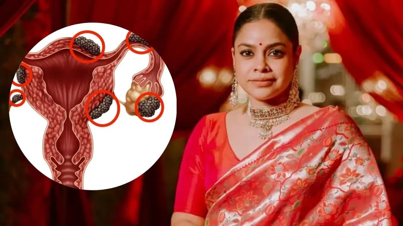 Sumona chakravarti went through endometriosis excision surgery know what is this medical condition and when you should consult a doctor