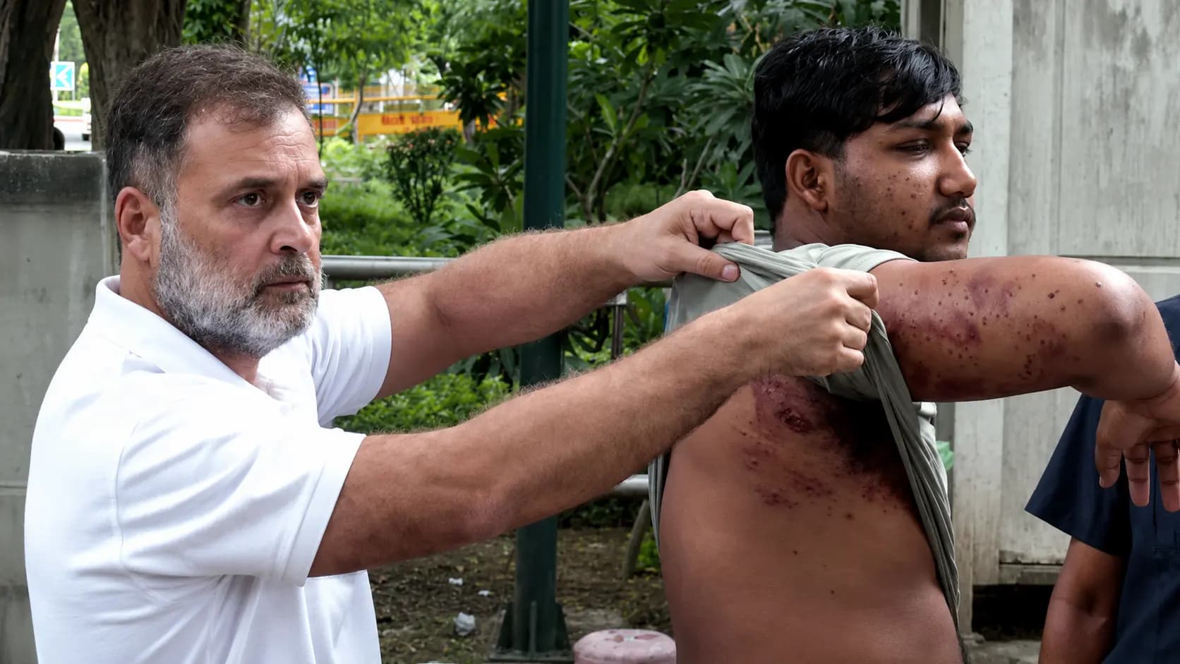 pellet guns were used to curve jantar mantar protest says rahul gandhi