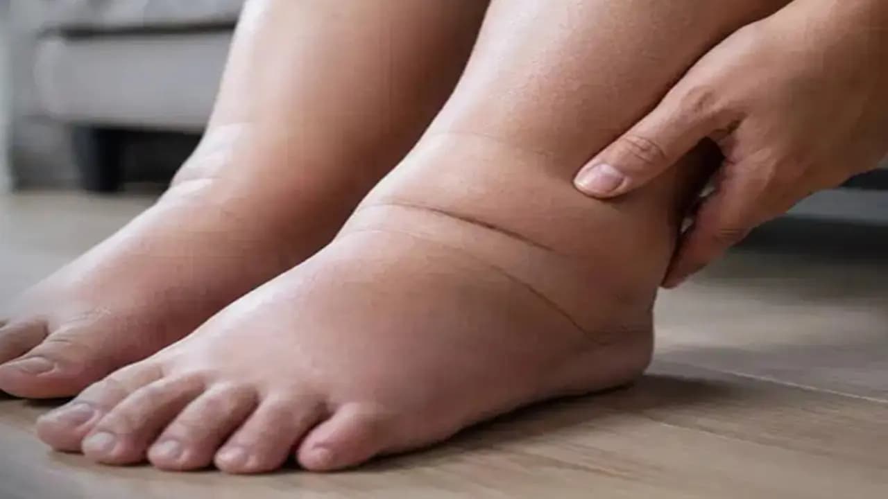 Swollen Feet Causes: Why Your Feet Swell Repeatedly and Warning Signs 