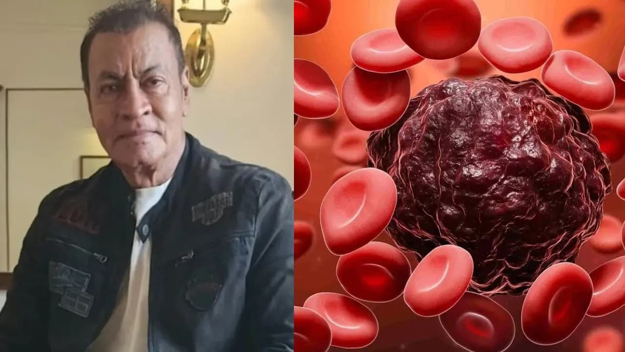 Pradeep Rawat Dies of Blood Cancer: Why Does Cancer Relapse Years After Cure