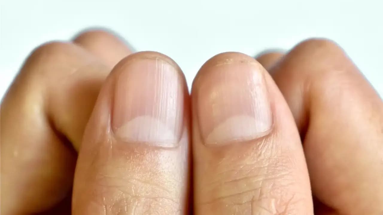 Nail Lunula Health Signs