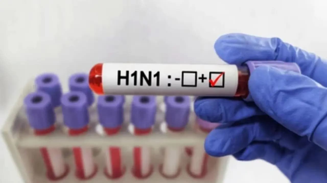 H1n1 spreading rapidly know who have higher risks including heart patients 