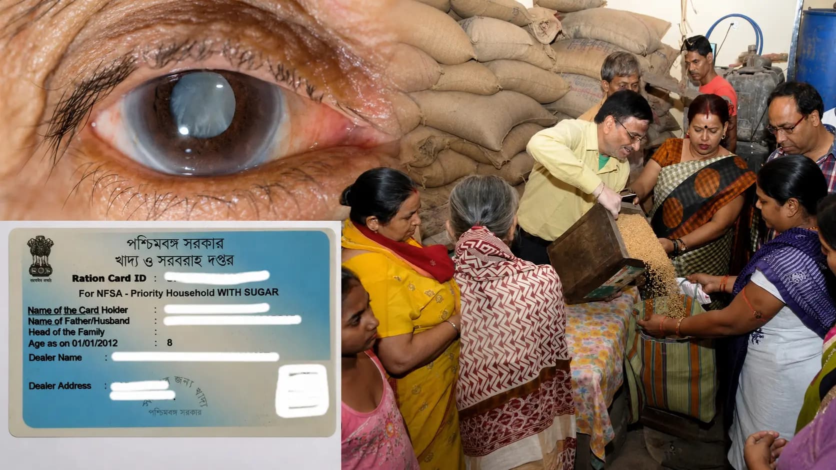 West Bengal Free Ration Cancellation: Cataract Problem? Will You Get Free Ration Anymore? Check West Bengal Government Announcement On Ration Card Cancellation Rules