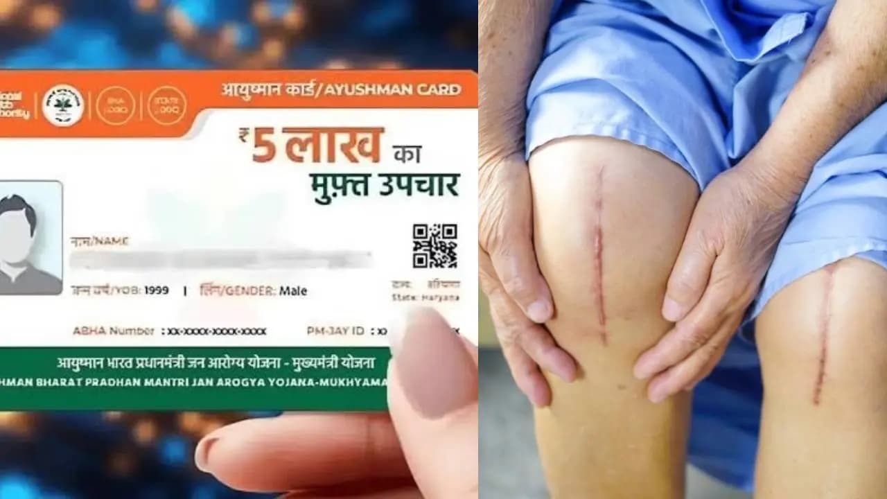 West Bengal Ayushman Bharat Free Treatment Knee Hip Replacement 1950 Packages hospital details