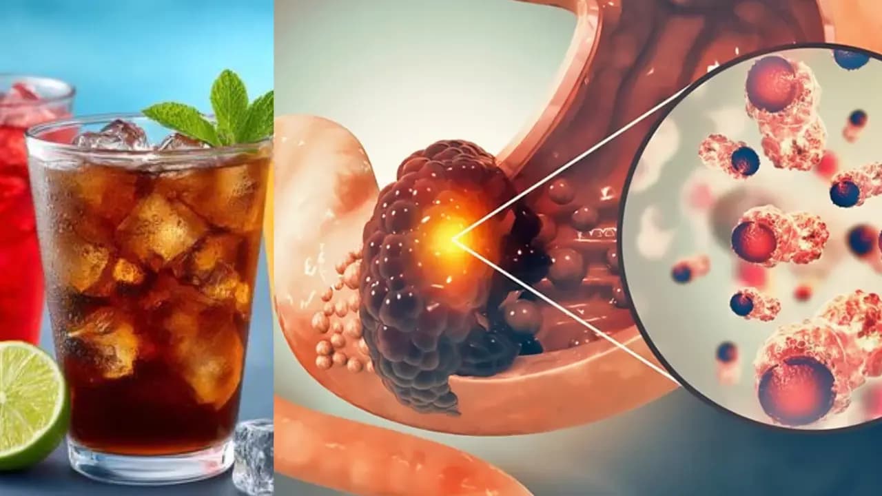 'Just a cold drink!' Is this daily habit increasing the risk of cancer? Research issues a warning